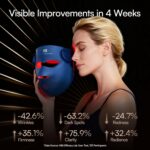 INIA Glow 4D Wireless Red Light Therapy Mask for face – Dual NIR, 320 LEDs, 4 Mo... - Image 4